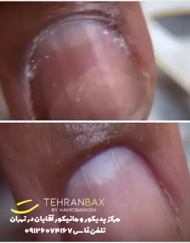 دورگیری ناخن در پدیکور و مانیکور