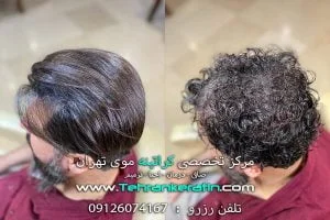 کراتینه موی آقایان در الهیه 
