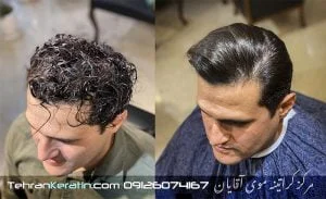 کراتینه موی آقایان در الهیه