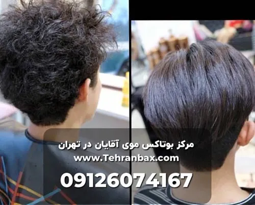 بوتاکس موی مردانه