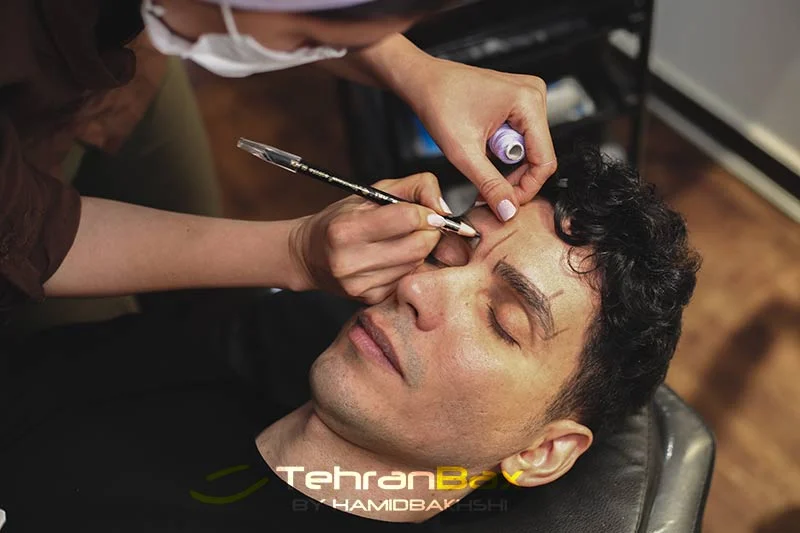 میکروبلیدینگ ابرو آقایان در تهران