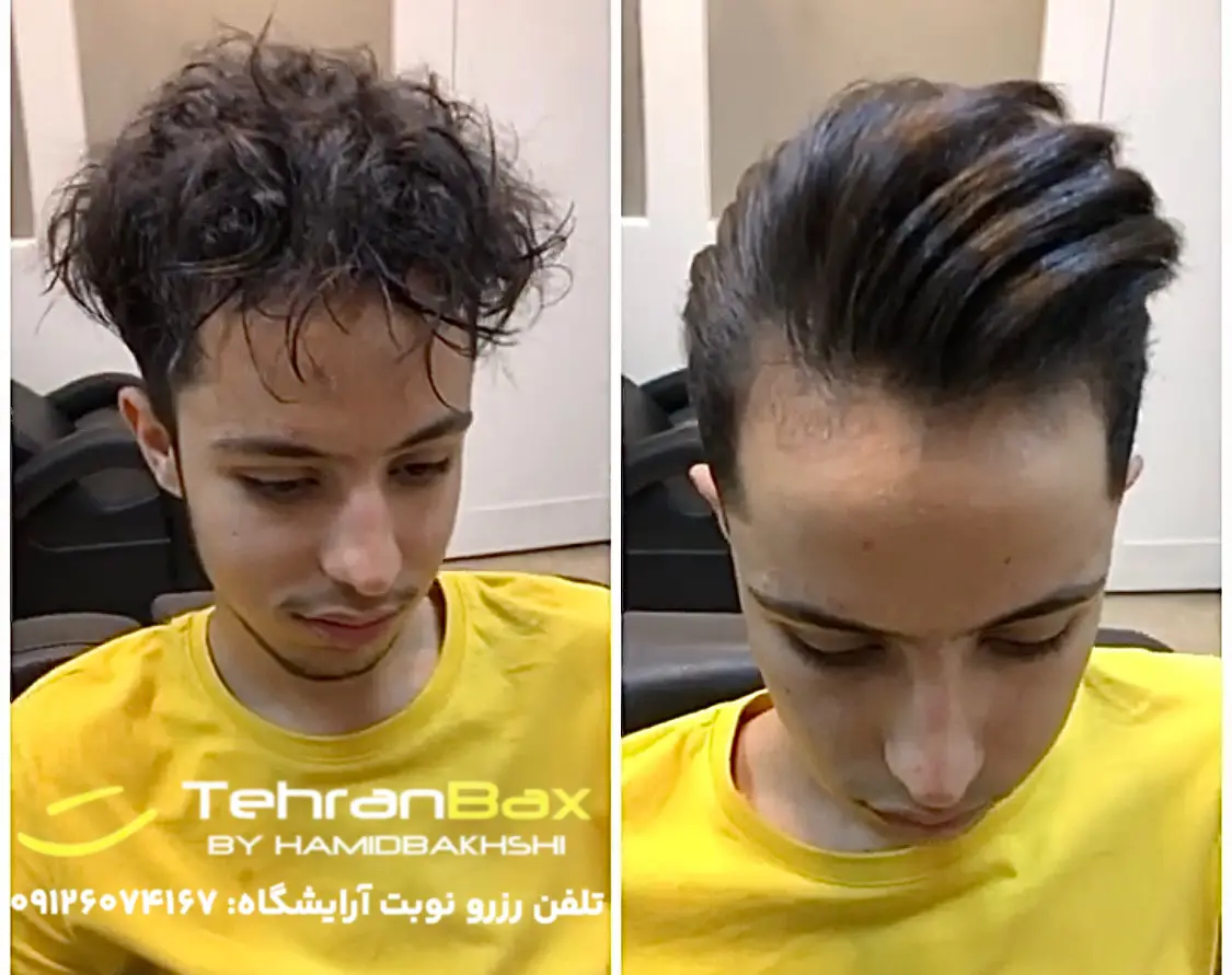 کراتینه مو مردانه