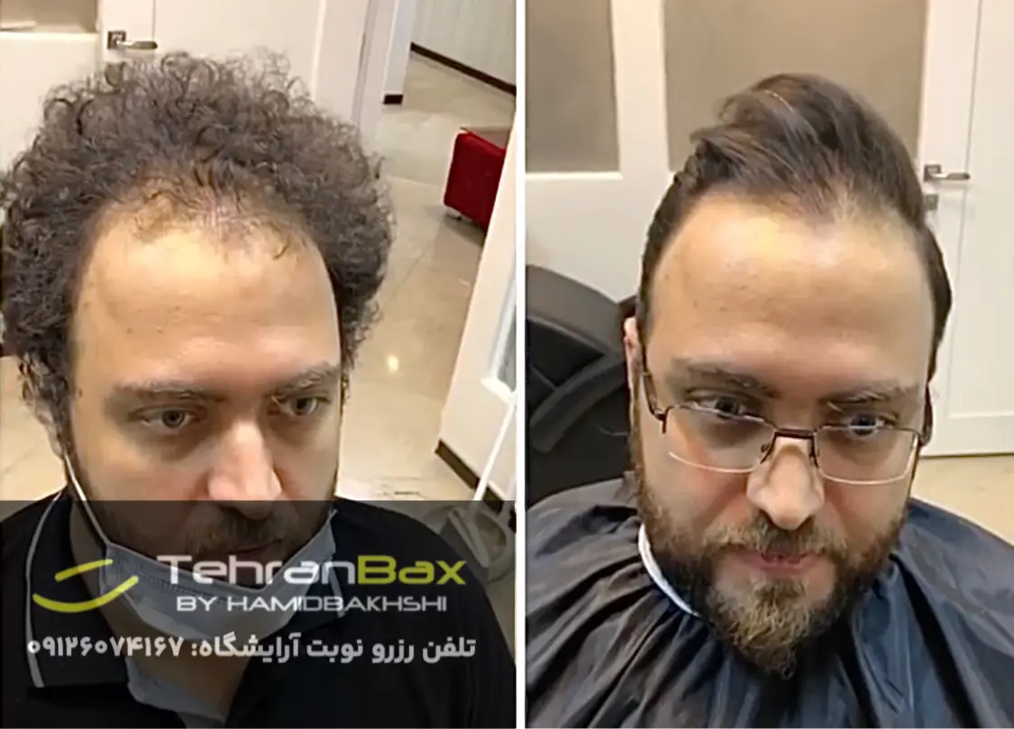 کراتینه مو آقایان