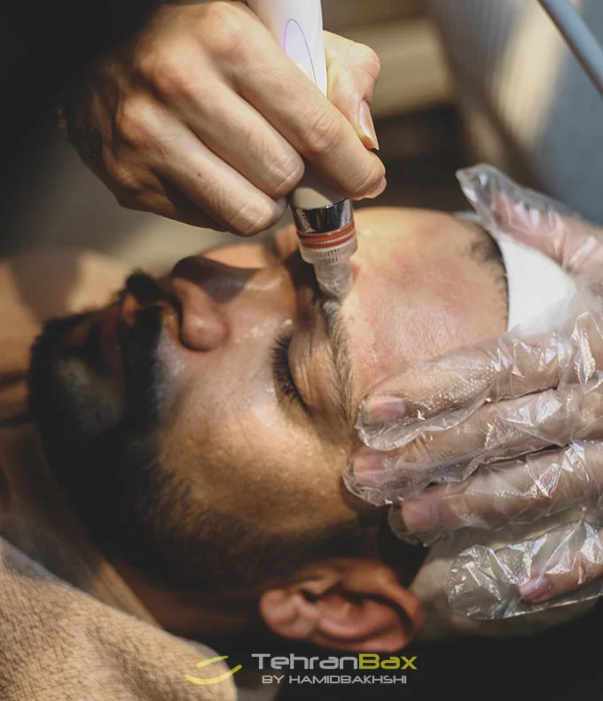 پاکسازی پوست آرایشگاه داماد در زعفرانیه تهران