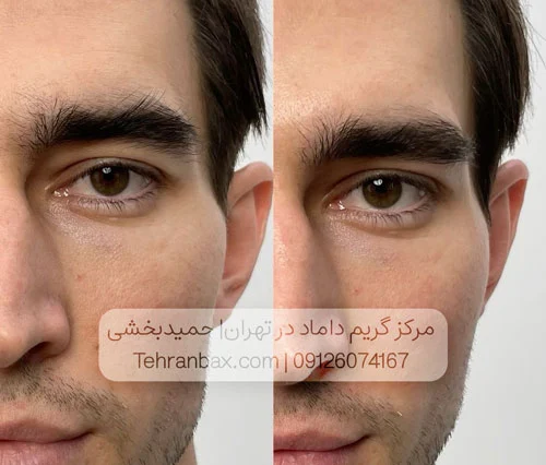 اصلاح ابروی داماد