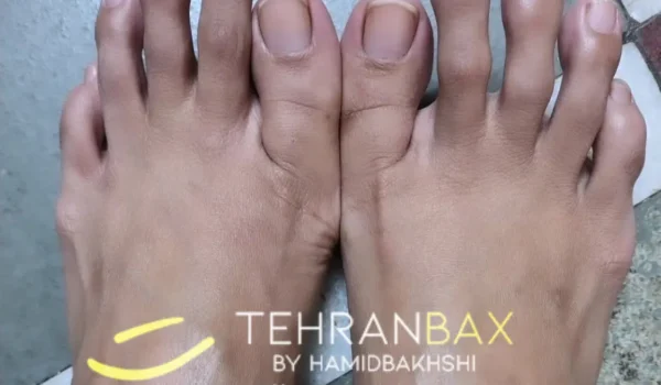 خنده دار ترین پاهای دنیا