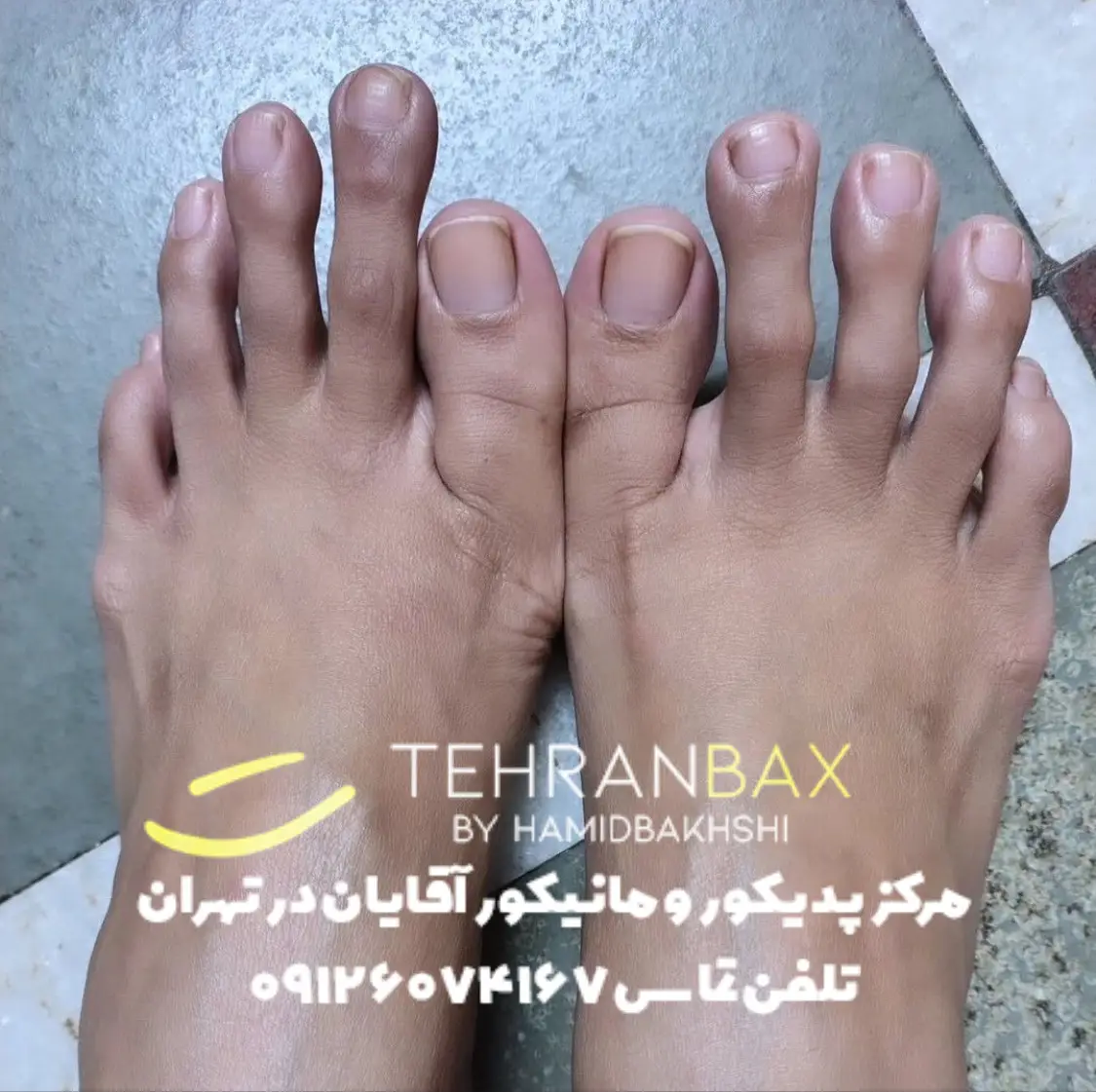 خنده دار ترین پاهای دنیا
