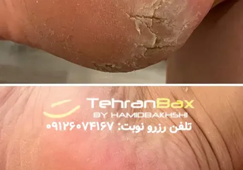 کفسابی پای مردانه در نیاوران