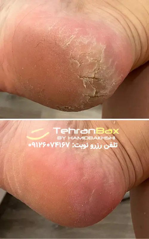 کفسابی پای مردانه در نیاوران