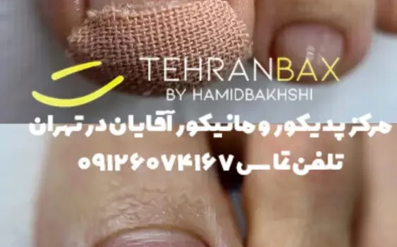 فرو رفتن ناخن داخل گوشت در مردان