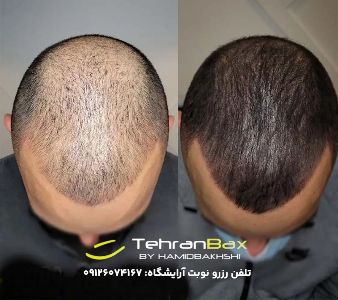تاپیک موی آقایان