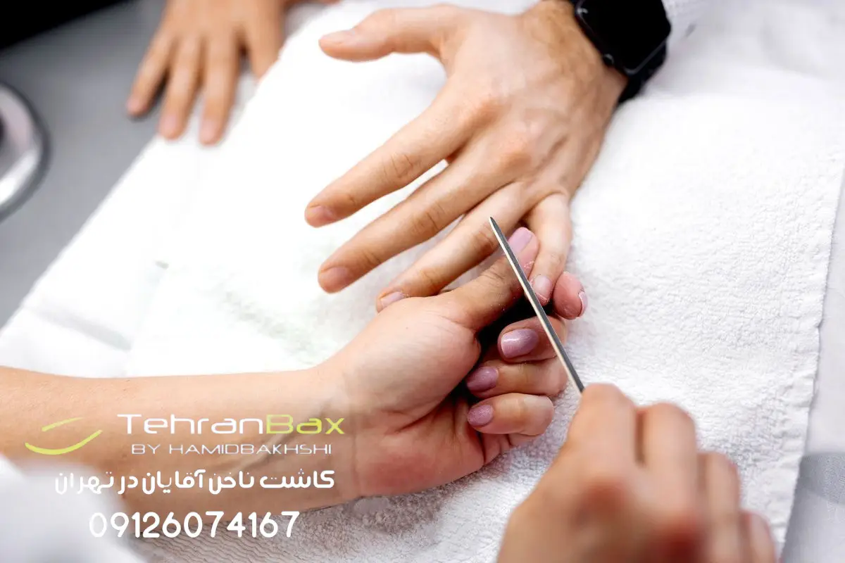 کاشت ناخن آقایان کجا انجام بدیم؟